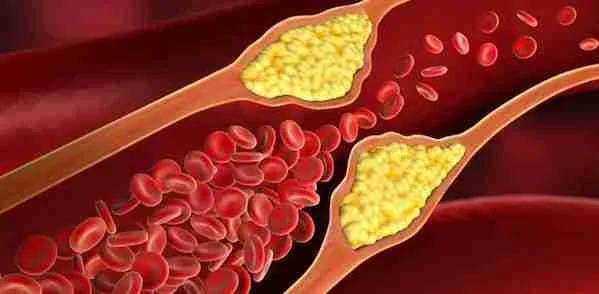 Five Tips for Lowering Cholesterol During Winter – Simple Changes & Swaps