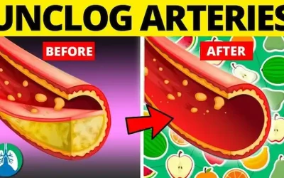 How To Reduce Plaque In Arteries Naturally